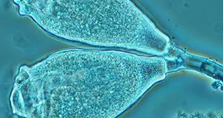 Picture of the BAS technology